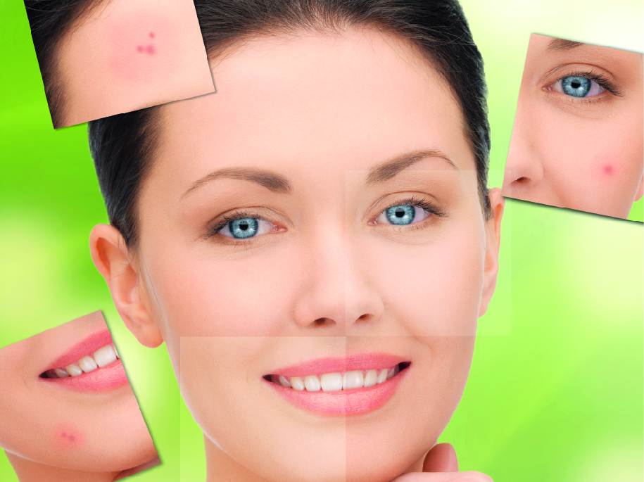 Types-of-acne-skiinaceclinic